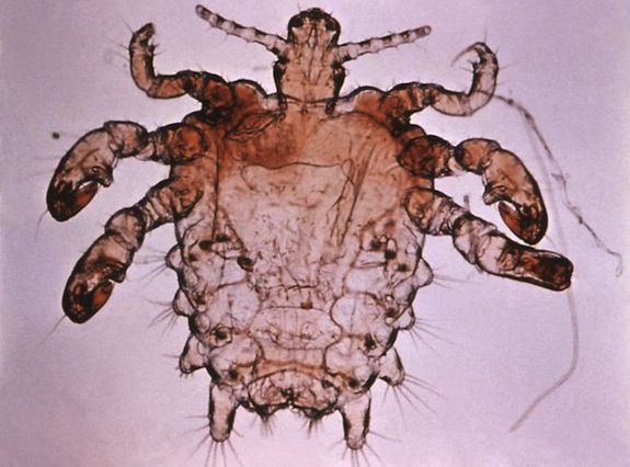 20130114092015Pthius_pubis_-_crab_louse.jpg