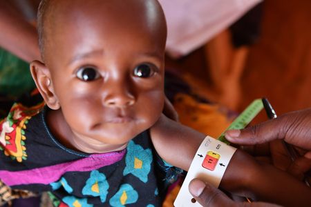 A UNICEF staff member measures the perimeter of an acute malnourished child's arm in Doolow, Somalia.
