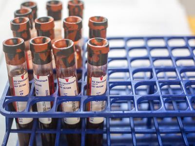 The U.K.'s National Health Service plans to test artificial blood in a clinical trial in 2017. 