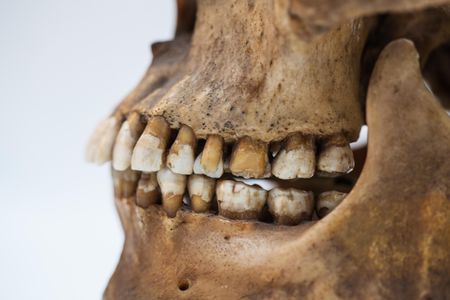 The truth is in the tooth
