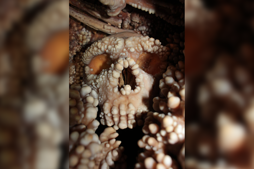 Skeleton covered in white blobs