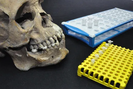 The men's remains, found in a 16th-century mass grave in Mexico City, bear signs of trauma and disease.