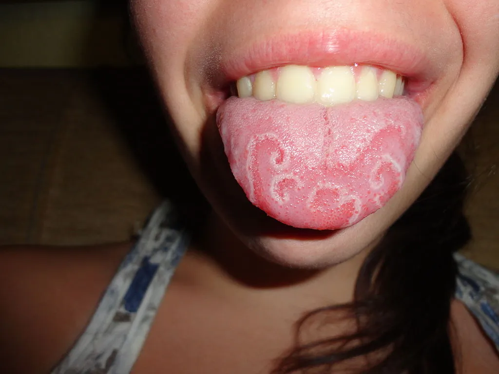 A geographic tongue by Martanopue via Wikimedia Commons.