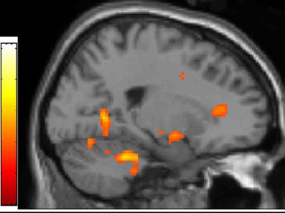 The orange dot on the right is the anterior cingulate cortex.