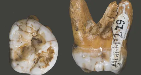 The molar tooth of a Denisovan