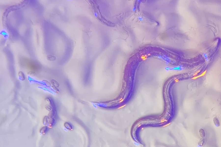 A photo of nematodes viewed under a microscope where they appear purple