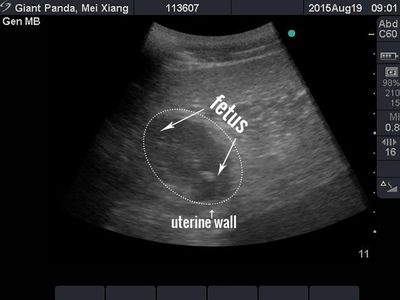 Veterinarians detected what they believe is a developing giant panda fetus in an ultrasound procedure on giant panda Mei Xiang. Based on the size of the fetus, which is about four centimeters, officials say that Mei Xiang could give birth early next week, or possibly in early September.
