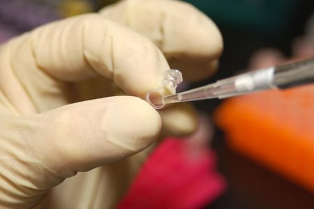 A researcher uses a pipette to remove DNA from a micro test tube. 