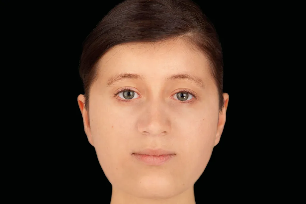 Facial reconstruction