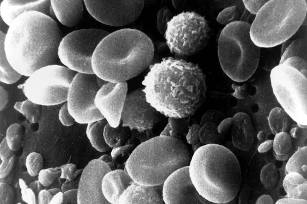 20131024101027SEM_blood_cells.jpg