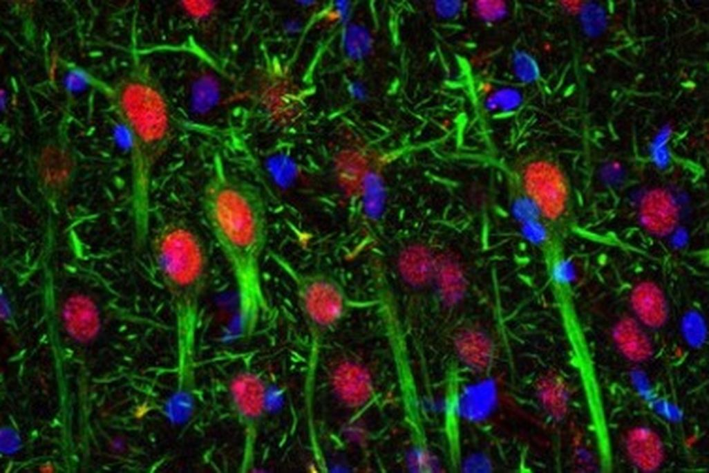 Brain cells, stained in red, are sensitive to hormones that influence appetite