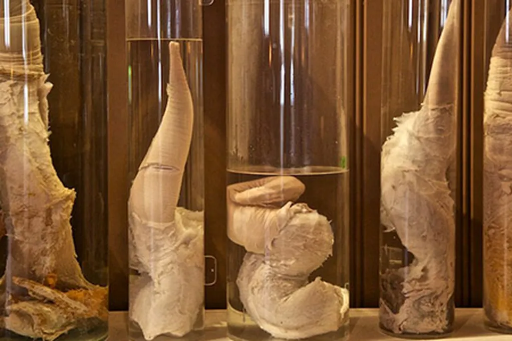 whale penises, penis museum