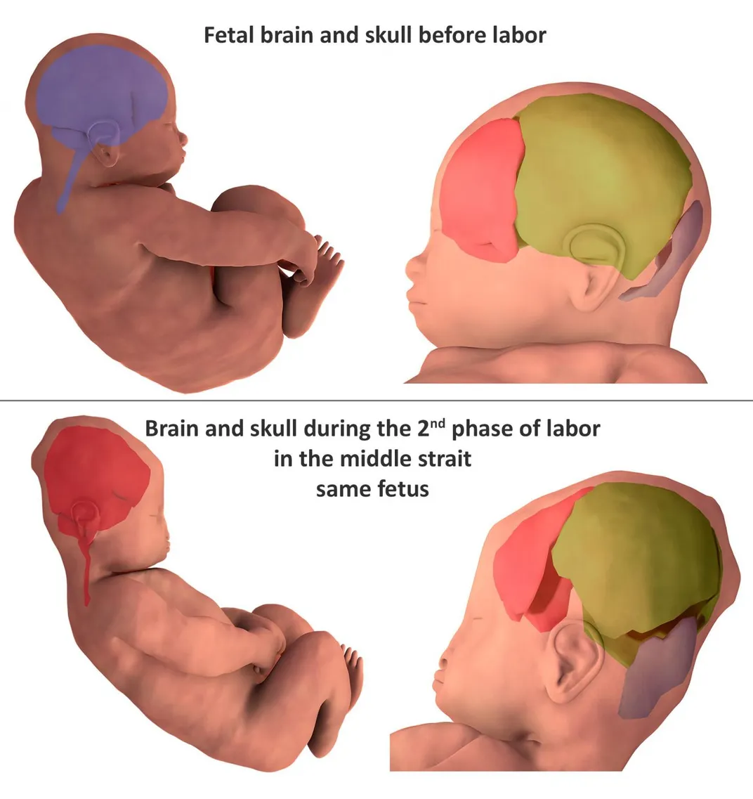 3-D Images Show Just How Much a Baby’s Head Changes During Birth