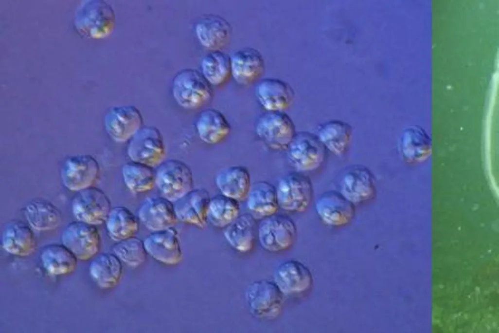 Myxozoa