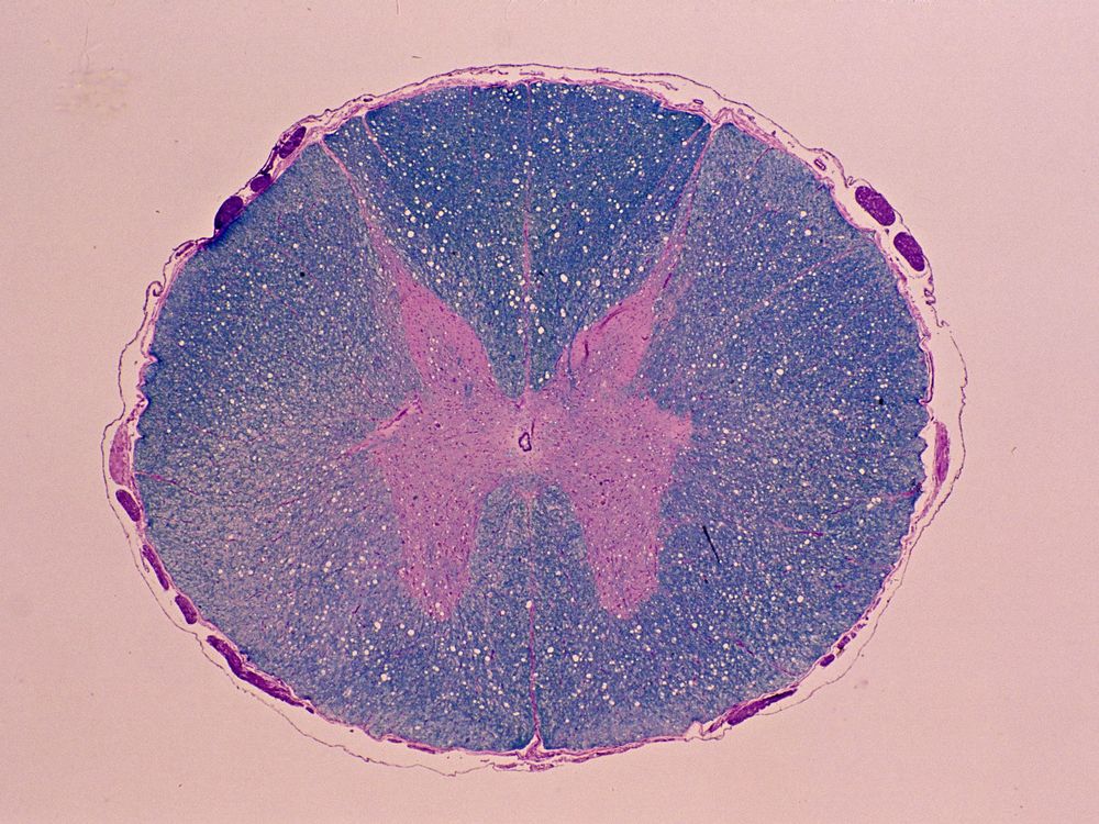 A cross-section of a spinal cord magnified five times.
