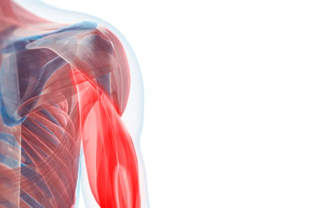 Triceps muscle