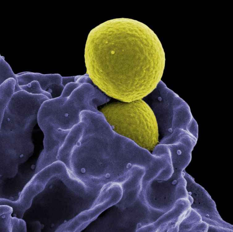 mrsa bacteria