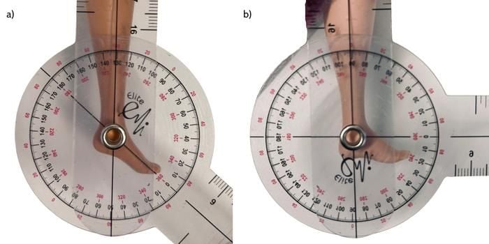 Barbie’s Feet Have Become Less Arched Over Time, According to a New Study by Podiatrists