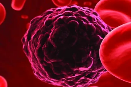 Scientists are able to detect the DNA of tumor cells floating in blood.
