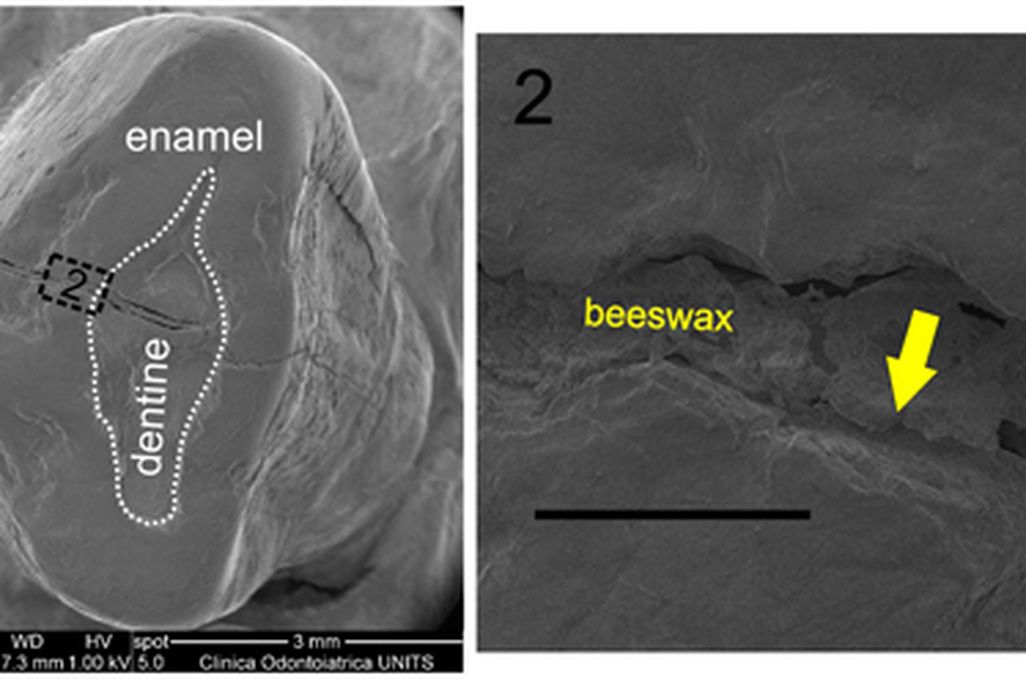A scanning electron microscope
