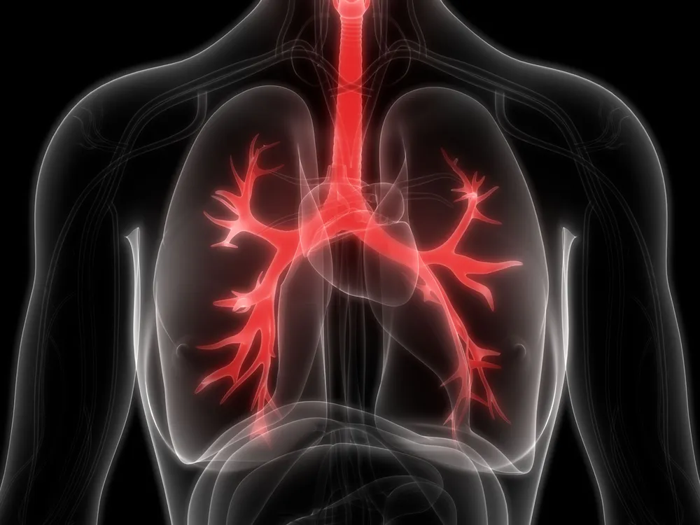 Human Lungs CF