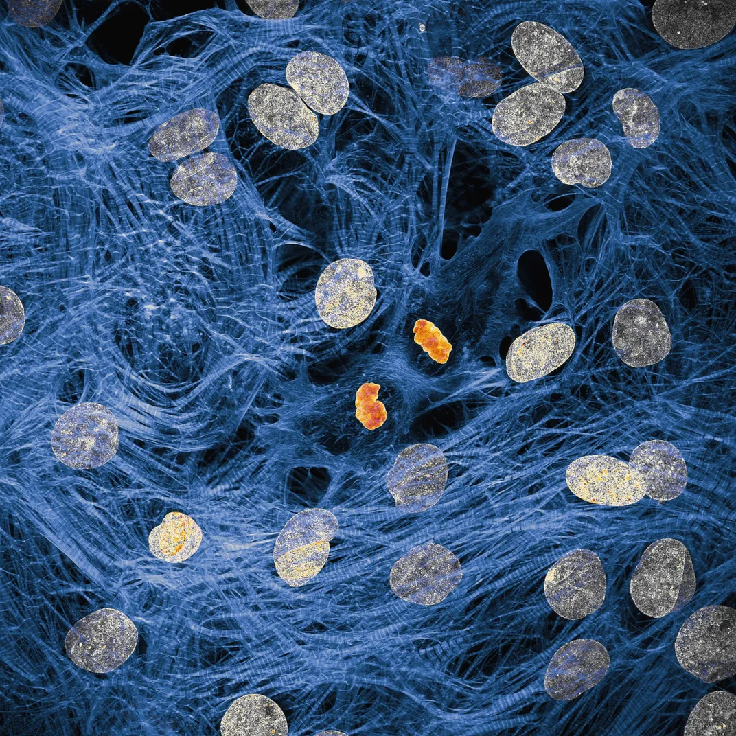 blue filaments with silver and red-orange objects