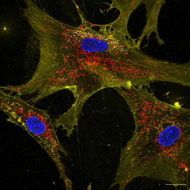 A New Way to Boost the Powerhouses of the Cell Might Combat Aging and ...