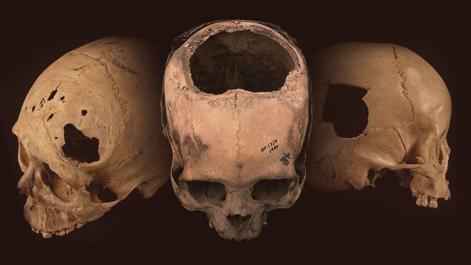 Skulls