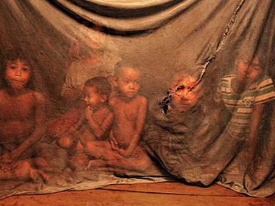 Cambodia children with malaria