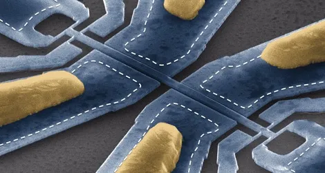 An electron scanning micrograph