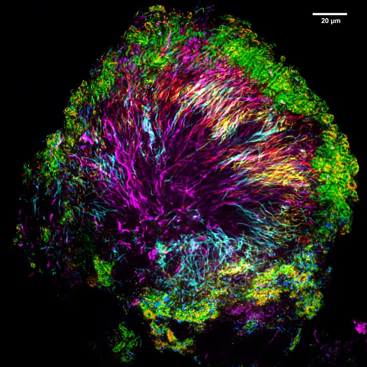 Dental plaque microbiome