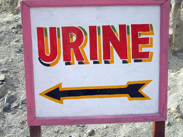 2013110810002811_08_2013_urine.jpg