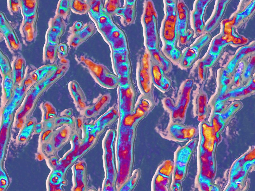 The fungus Aspergillus fumigatus, as seen under an optical microscope.