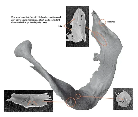 3D view of a jaw bone against a white backdrop