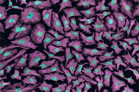 Henrietta Lacks was a real person—and her cancer cells have led to many medical discoveries. 