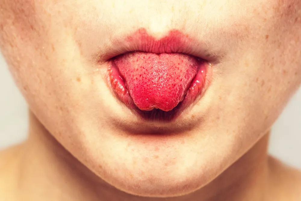 Taste receptors for salty, sweet, bitter and sour are found all over the tongue.