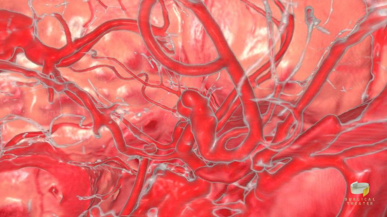 Preview thumbnail for Watch This Virtual “Fly Through” of a Human Brain