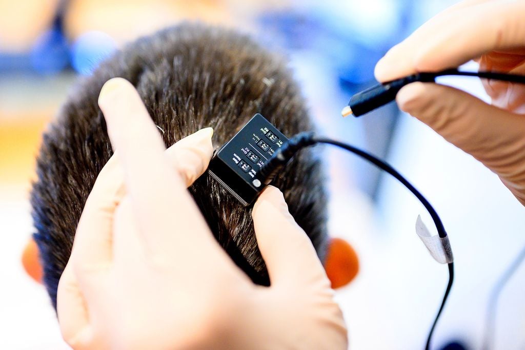 Researchers connect Ann's brain implant to the computer.