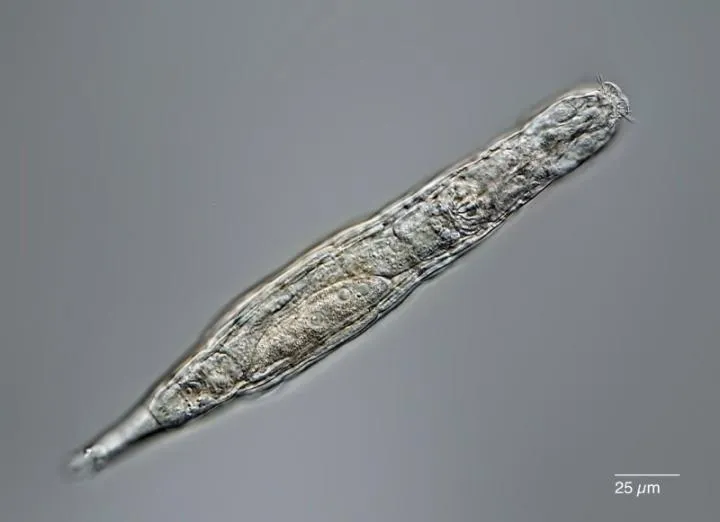 A rotifer seen under a microscope