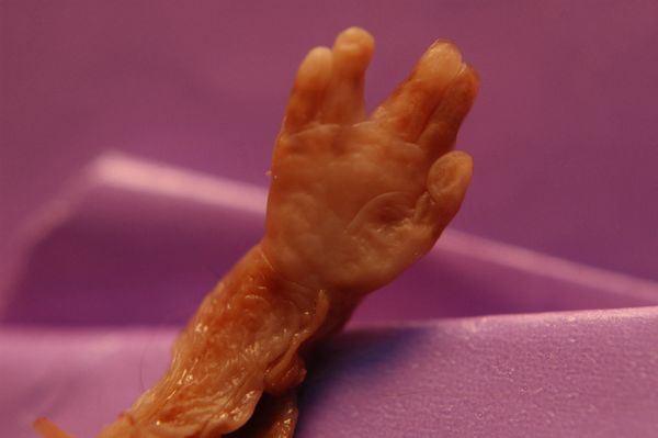 "I'm Here Too"
Hand of aborted baby--with life-line. thumbnail