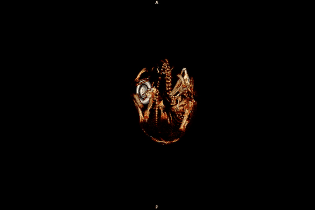 Moving image of skeleton inside shell
