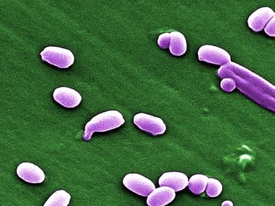 Spores of the Anthrax bacillus. 