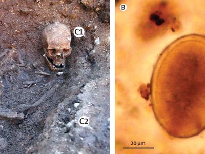 A sacral sample (S) taken from Richard III revealed ancient roundworm eggs. Control samples from his skull (C1) and outside of the grave (C2) linked the infection to his body.