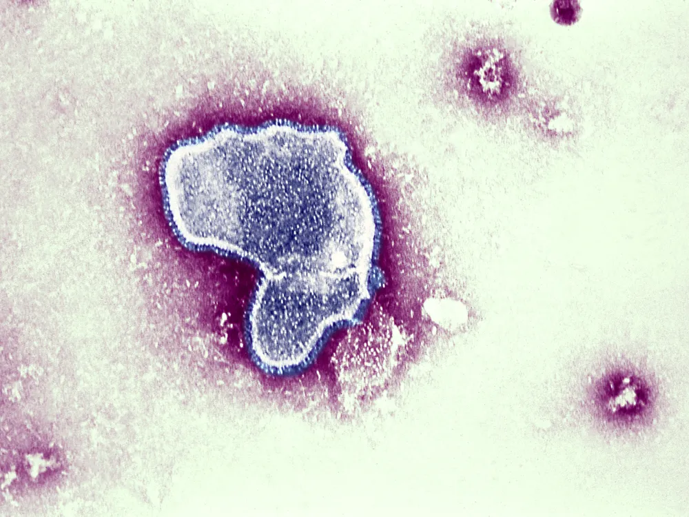 An image of the RSV virus