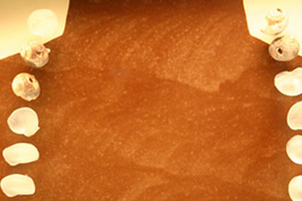 Perhaps necklaces