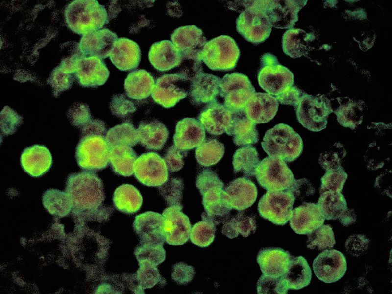 Naegleria fowleri