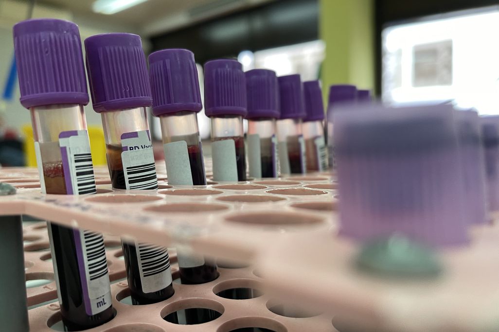 Monkeypox blood samples