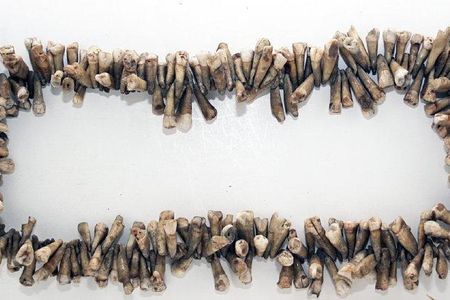 "Painless Parker" wore a necklace of teeth to lure in achy victims. 
