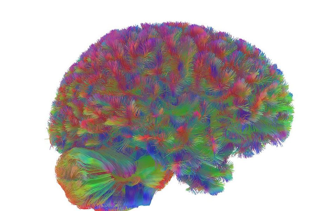 A colorful human brain