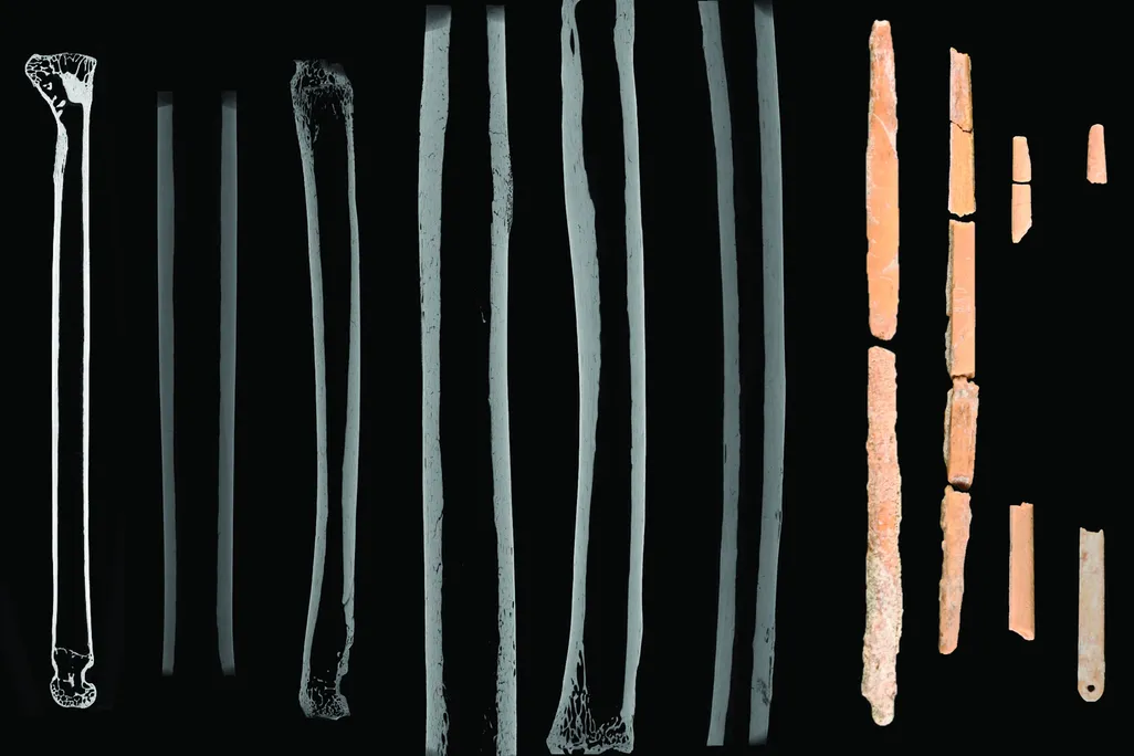 Bone needle scans